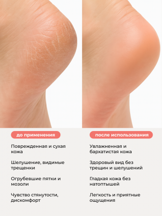 MANITA   Крем для ног   С МОЧЕВИНОЙ 12%   500мл   {7724}